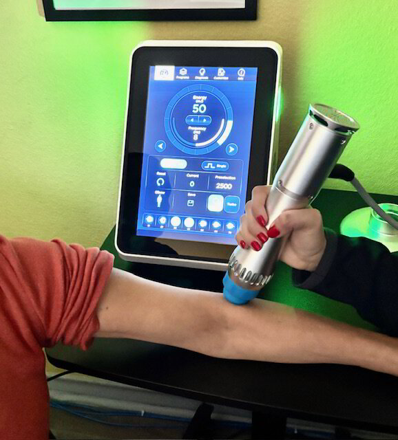 Shockwave therapy treatment at Spinology in San Antonio, TX